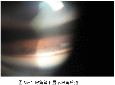 ZY016_154_3.gif